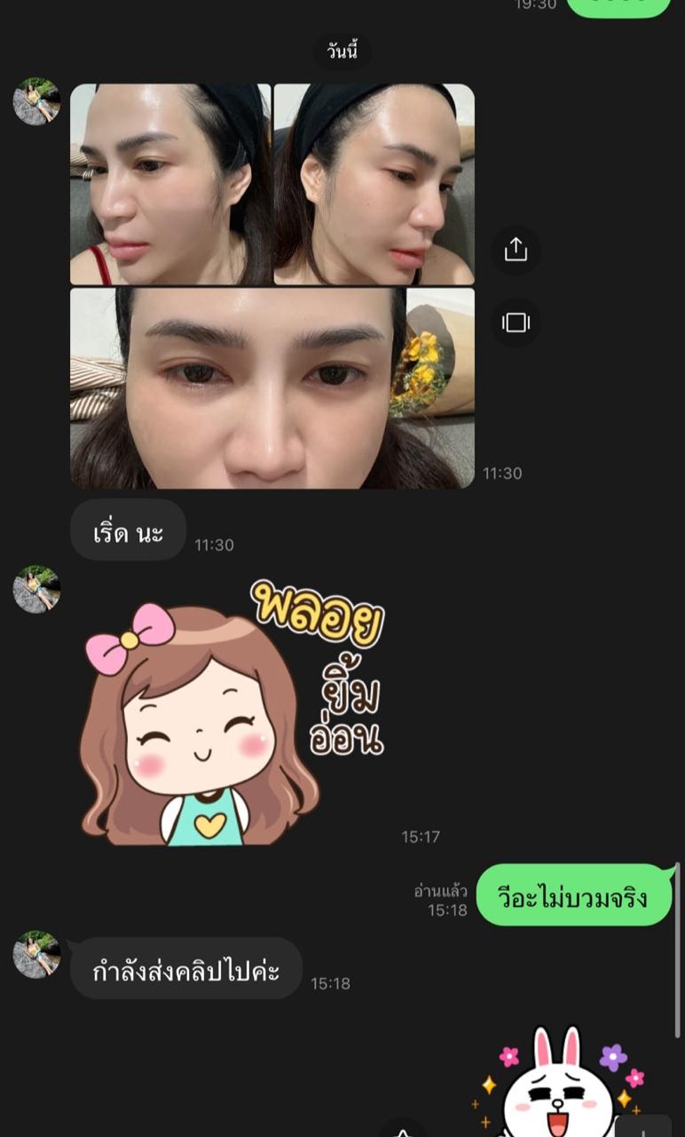 รีวิวหลังรับบริการจากข้อความลูกค้า KPB Clinic